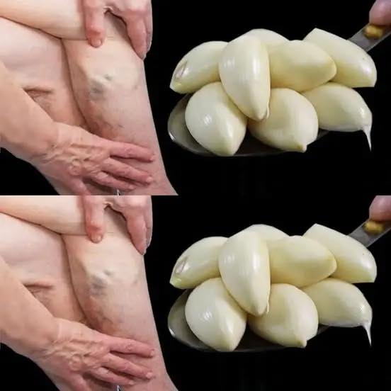 The Healing Power of Garlic and Black Pepper: Natural Relief for Pain and Inflammation