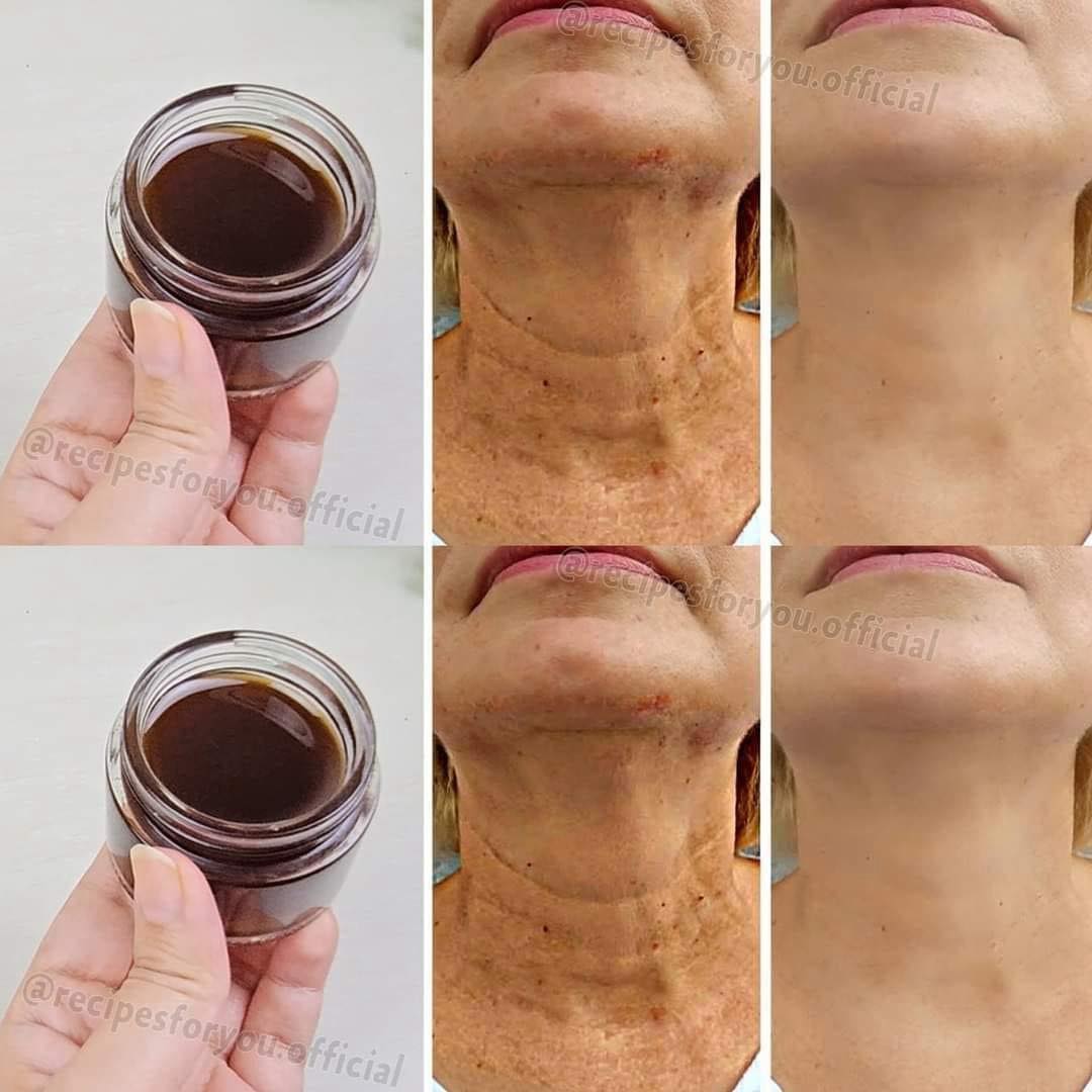 Anti-Aging Magic Oil: This Natural Blend Will Erase Wrinkles More Effectively Than Botox