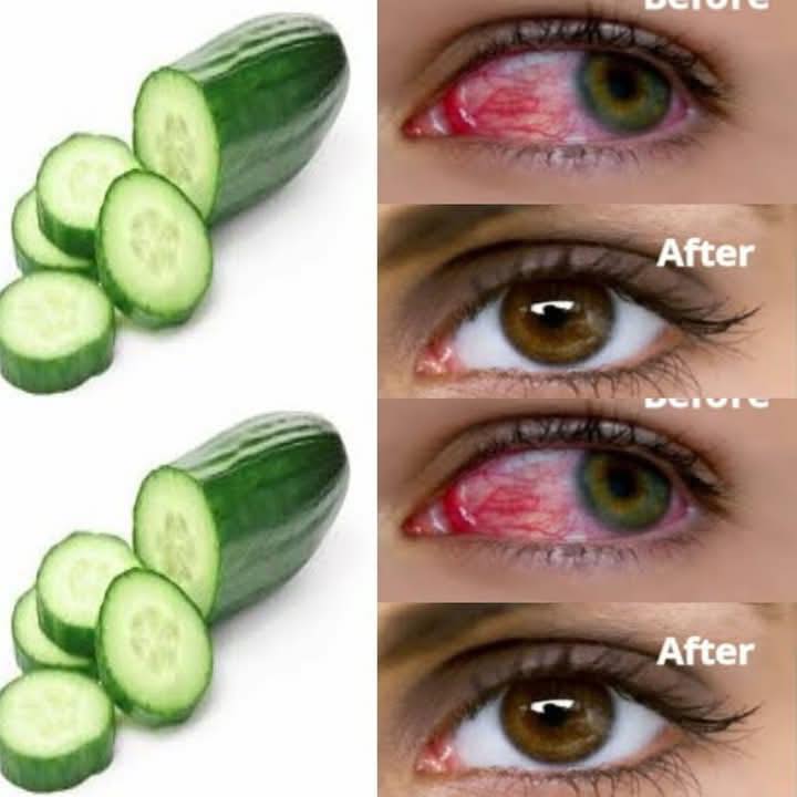 Daily Cucumber Elixir for Enhanced Eyesight: Your Natural Vision Support System